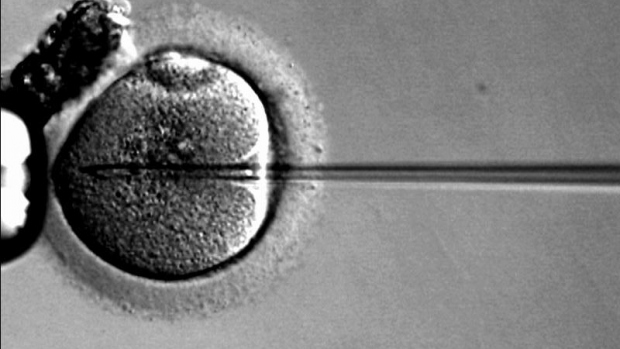 Mimotělní oplodnění (IVF + ET) - obrázek