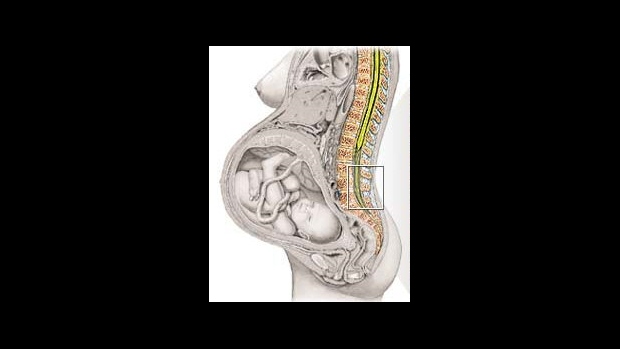 Porodní mechanizmus - obrázek