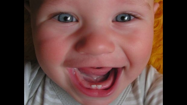 Běžné kojenecké neduhy - bolestivé prořezávání zoubků - obrázek